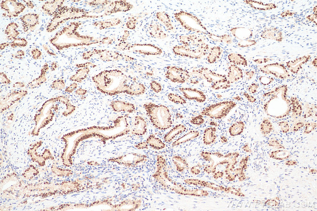 NKX3-1 Antibody in Immunohistochemistry (Paraffin) (IHC (P))
