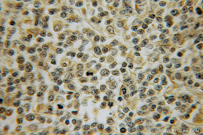 PTPRA Antibody in Immunohistochemistry (Paraffin) (IHC (P))