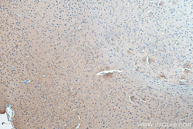 PEX5L Antibody in Immunohistochemistry (Paraffin) (IHC (P))