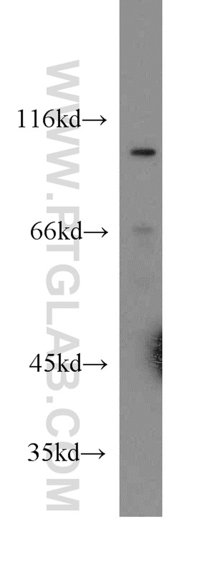 Cadherin-18 Antibody in Western Blot (WB)