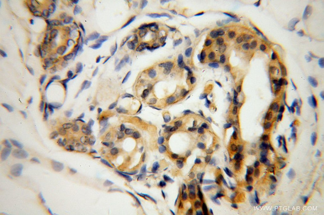 DCT Antibody in Immunohistochemistry (Paraffin) (IHC (P))