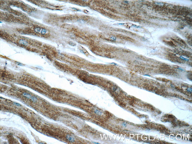 ADRB2 Antibody in Immunohistochemistry (Paraffin) (IHC (P))