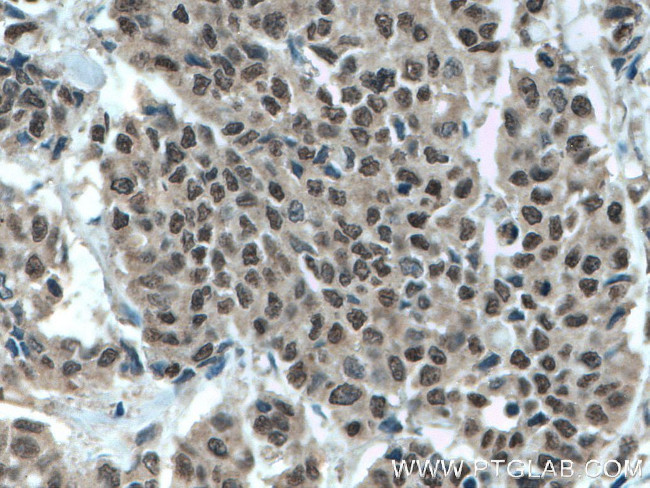 MLF1 Antibody in Immunohistochemistry (Paraffin) (IHC (P))