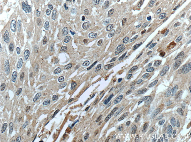SERPINB8 Antibody in Immunohistochemistry (Paraffin) (IHC (P))