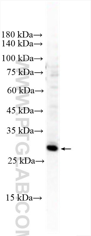 ELF5 Antibody in Western Blot (WB)