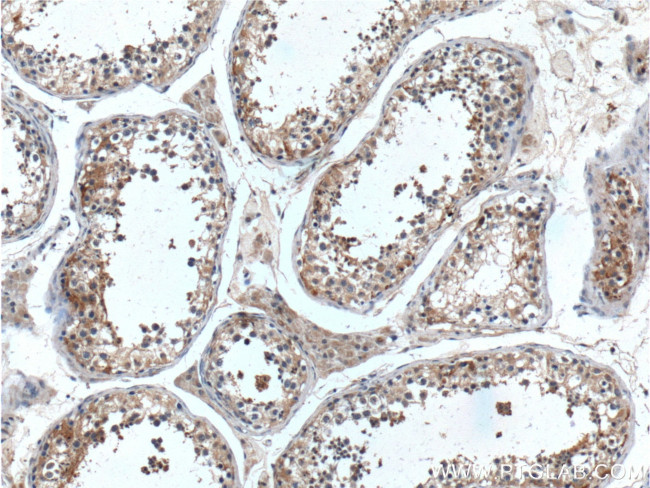 UBXN11 Antibody in Immunohistochemistry (Paraffin) (IHC (P))