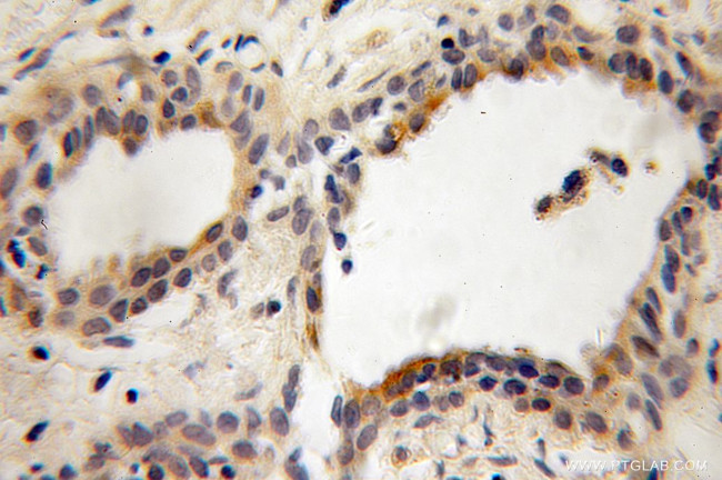 PITPNB Antibody in Immunohistochemistry (Paraffin) (IHC (P))