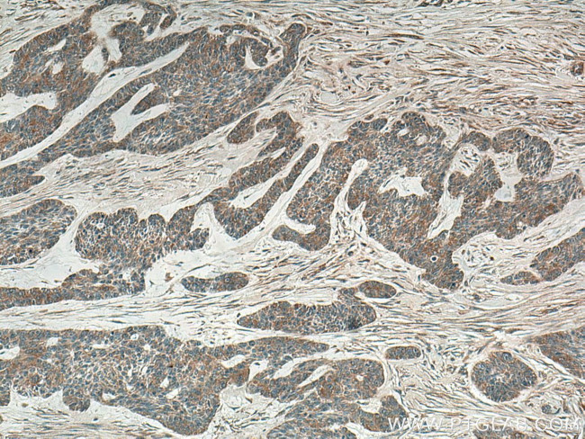 IL36RN Antibody in Immunohistochemistry (Paraffin) (IHC (P))