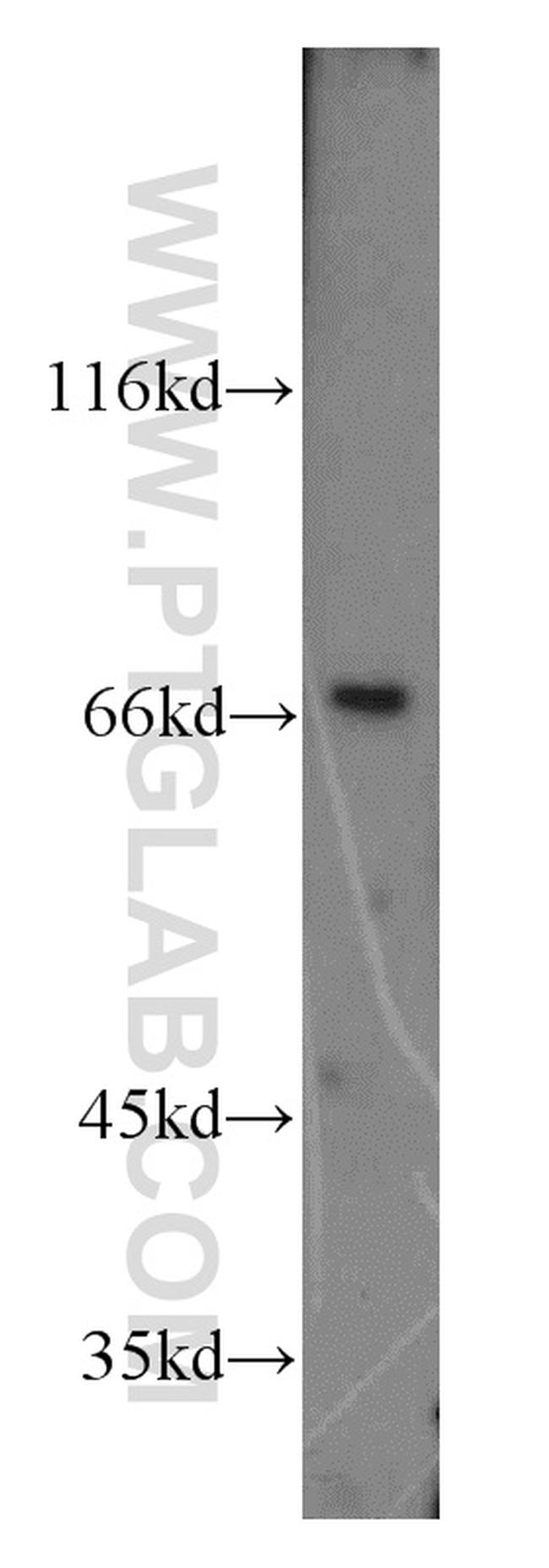 LNX1 Antibody in Western Blot (WB)