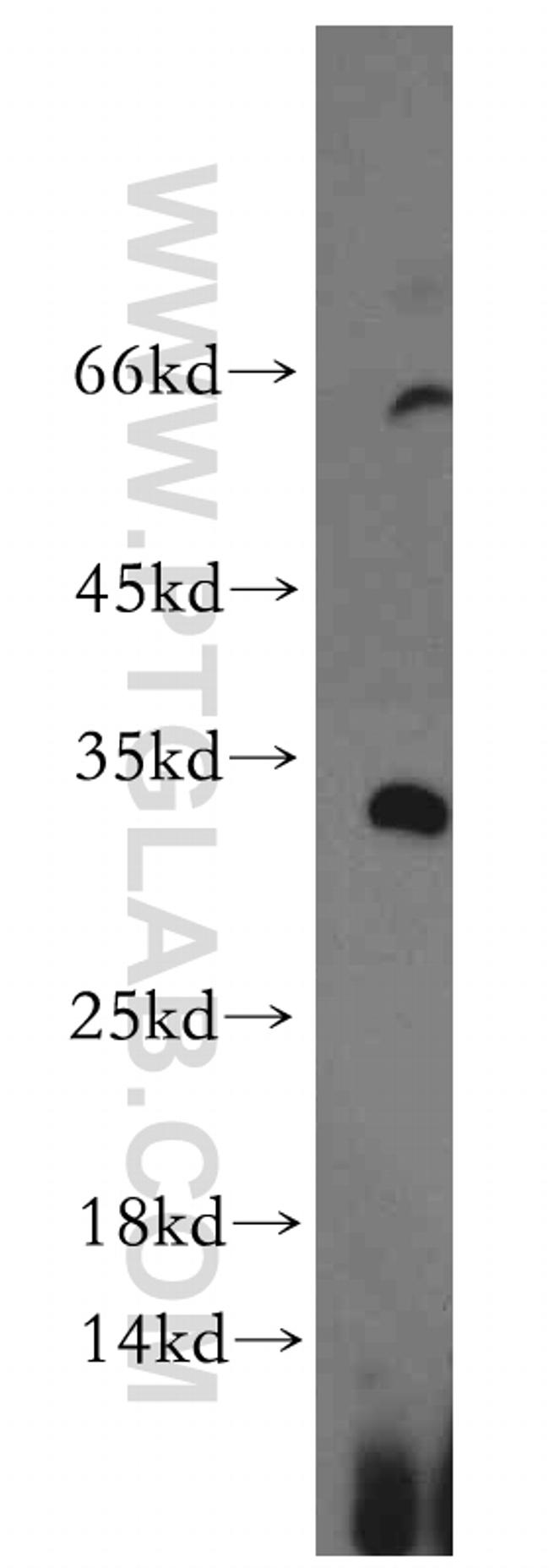 KLF7 Antibody in Western Blot (WB)