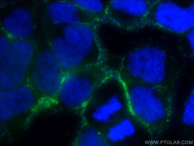 ORAI1 Antibody in Immunocytochemistry (ICC/IF)