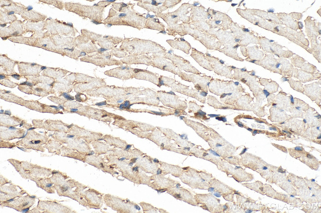 SNTA1 Antibody in Immunohistochemistry (Paraffin) (IHC (P))