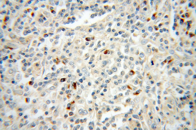 TRAV20 Antibody in Immunohistochemistry (Paraffin) (IHC (P))