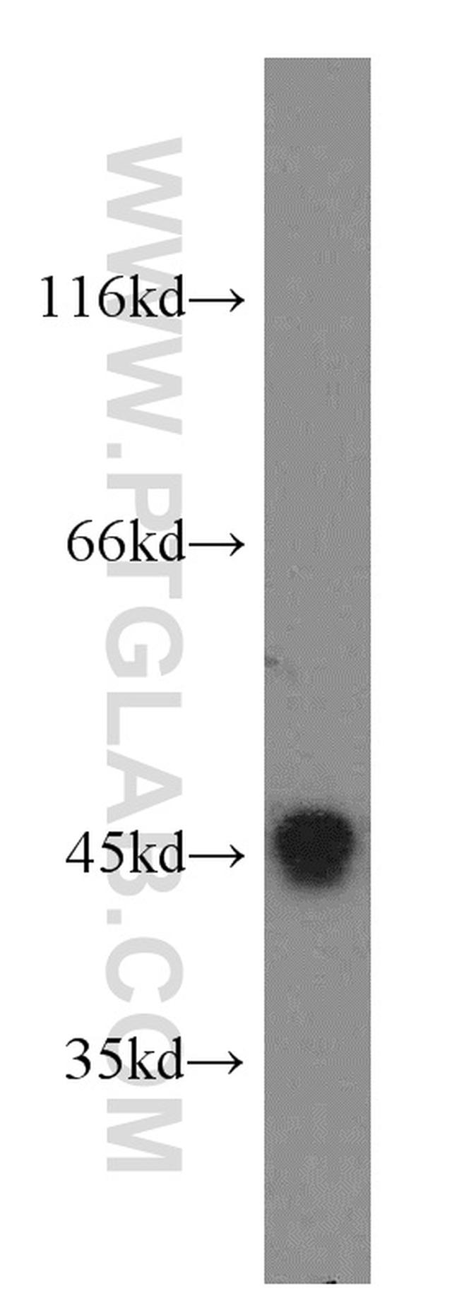 CCNL1 Antibody in Western Blot (WB)