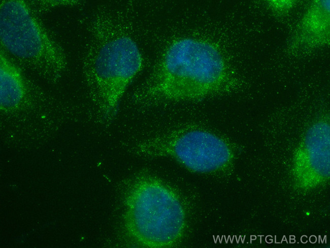 FGD1 Antibody in Immunocytochemistry (ICC/IF)