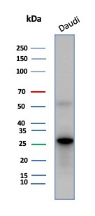 CD200 Receptor 1 (CD200R1)/OX2 Antibody in Western Blot (WB)