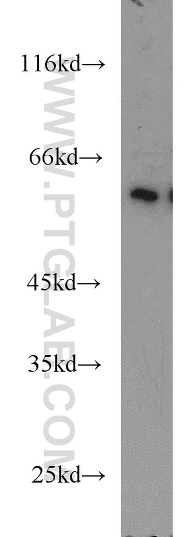 ZC3HC1 Antibody in Western Blot (WB)