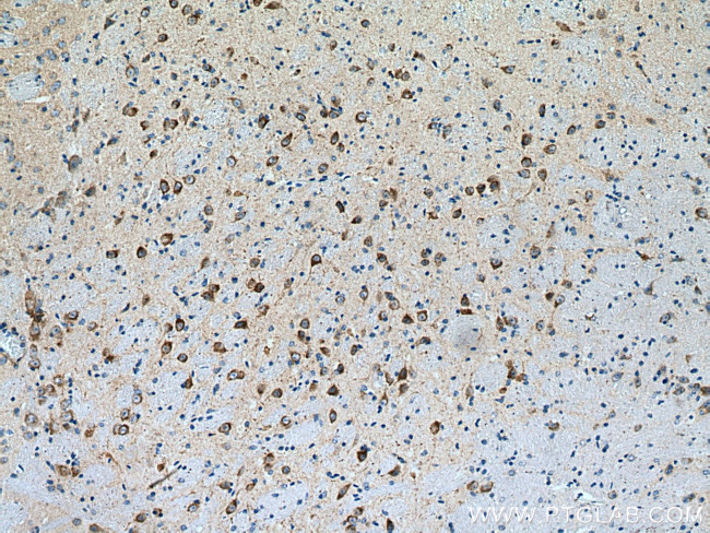 GDAP1 Antibody in Immunohistochemistry (Paraffin) (IHC (P))
