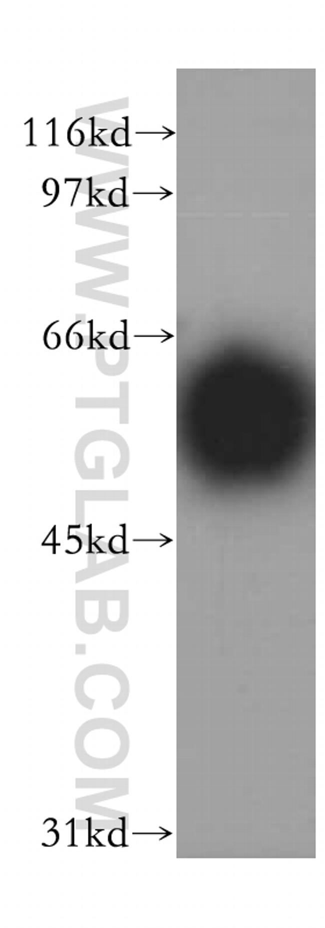 IP6K2 Antibody in Western Blot (WB)