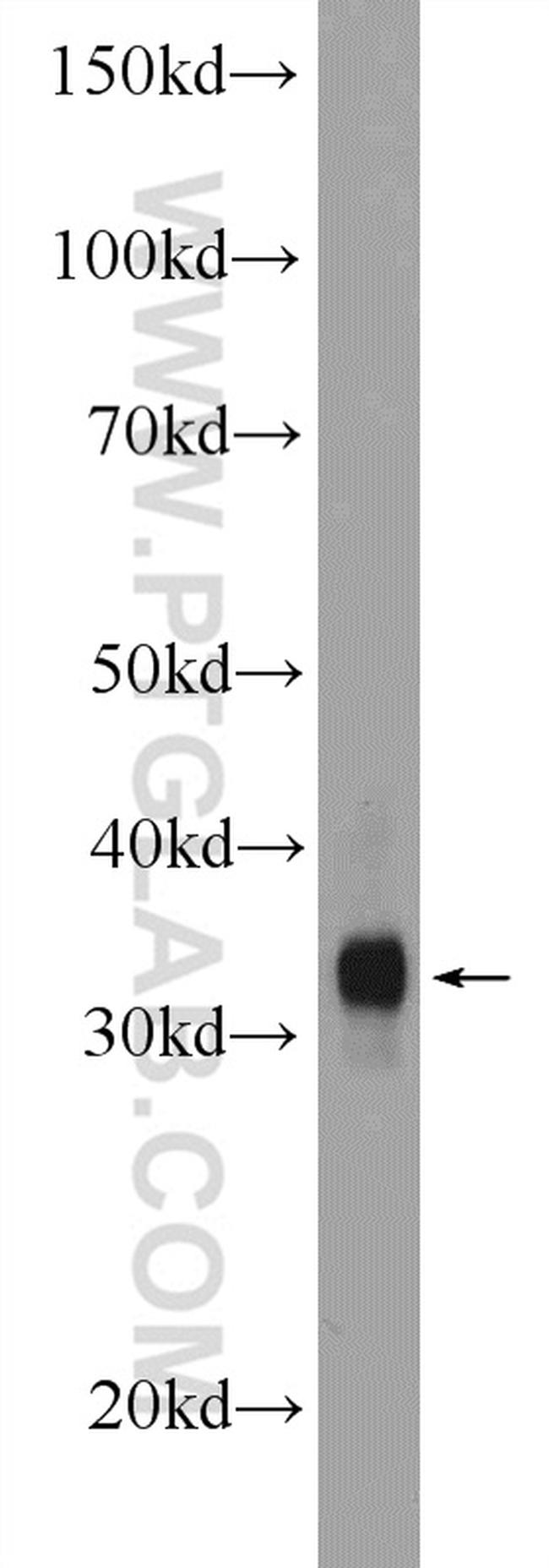 MYOZ1 Antibody in Western Blot (WB)