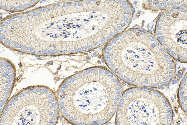 SLC26A3 Antibody in Immunohistochemistry (Paraffin) (IHC (P))