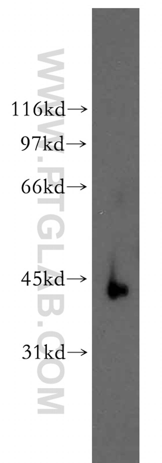 RBMS2 Antibody in Western Blot (WB)