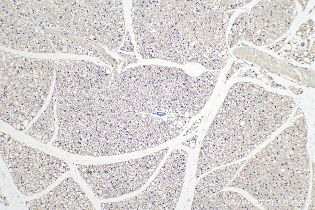 CIDEA Antibody in Immunohistochemistry (Paraffin) (IHC (P))