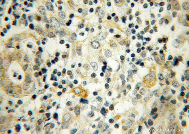 UBTD2 Antibody in Immunohistochemistry (Paraffin) (IHC (P))