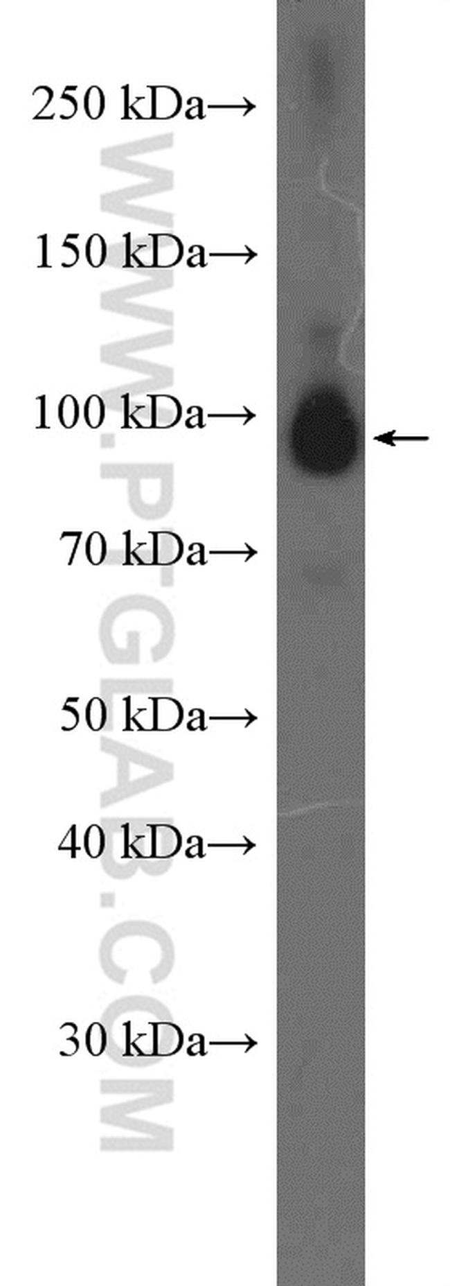 RALBP1 Antibody in Western Blot (WB)