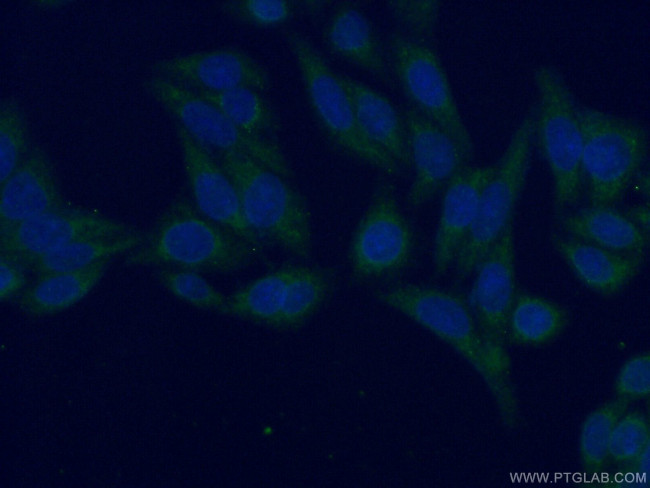 APBB2 Antibody in Immunocytochemistry (ICC/IF)