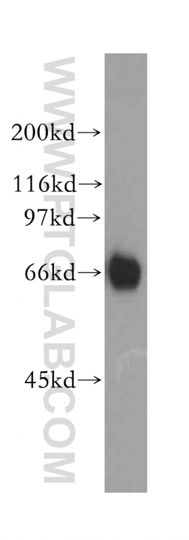 RBBP5 Antibody in Western Blot (WB)