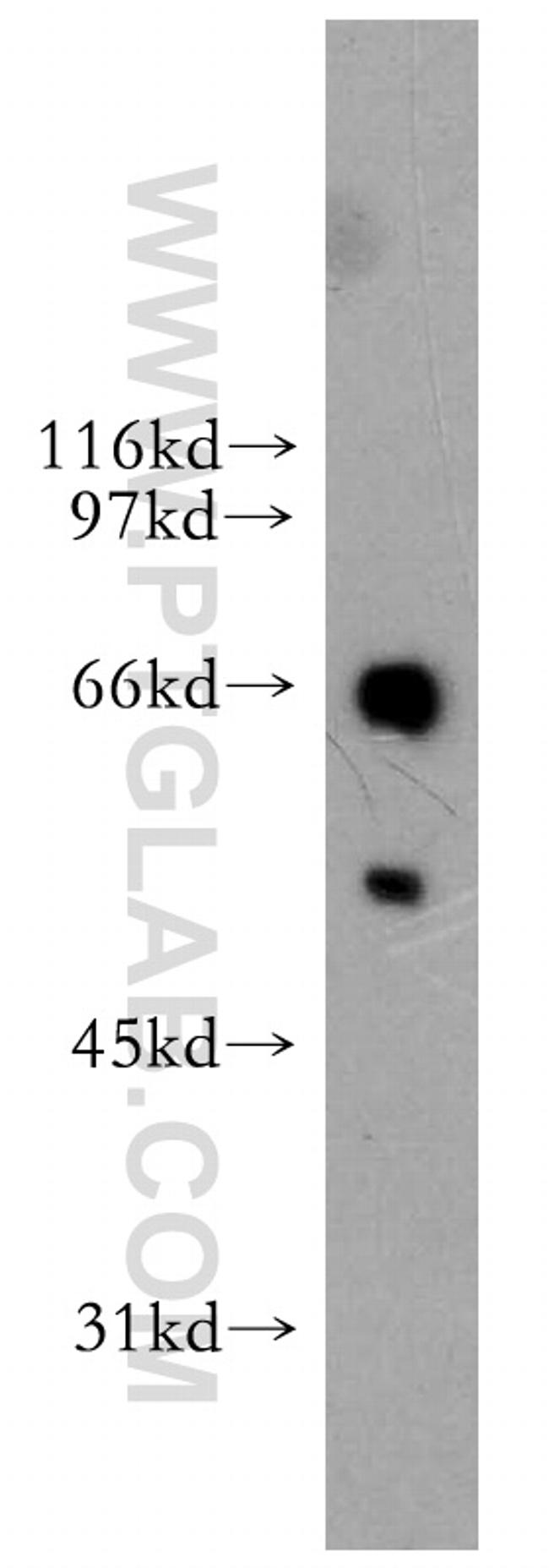 ETV6 Antibody in Western Blot (WB)
