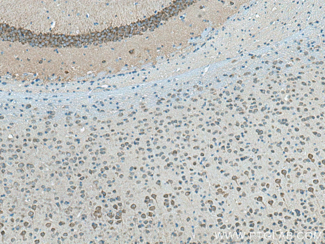 Neurochondrin Antibody in Immunohistochemistry (Paraffin) (IHC (P))