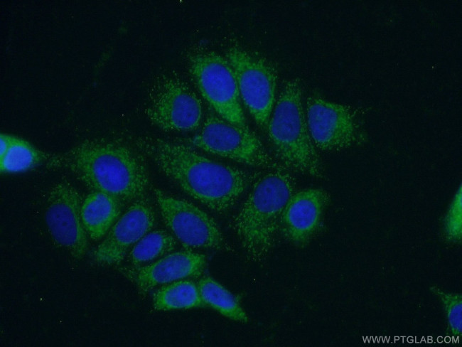 PPM1B Antibody in Immunocytochemistry (ICC/IF)