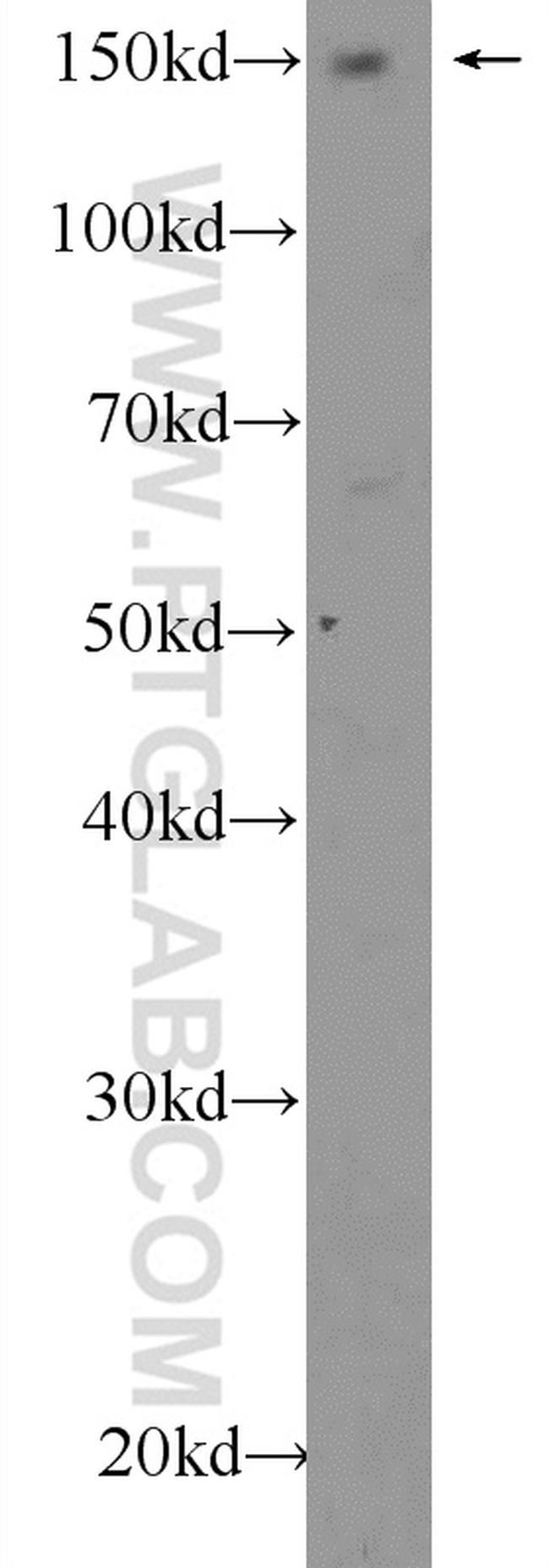 AFF4 Antibody in Western Blot (WB)