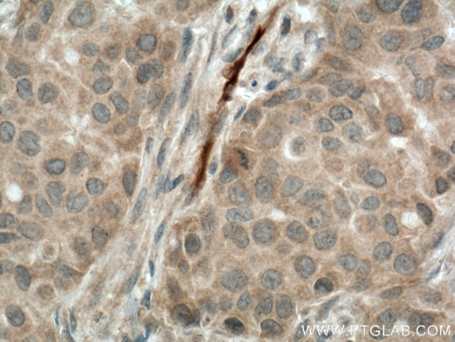 CA1 Antibody in Immunohistochemistry (Paraffin) (IHC (P))