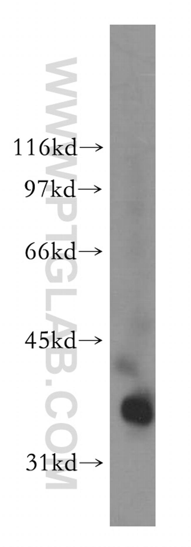 PDLIM3 Antibody in Western Blot (WB)