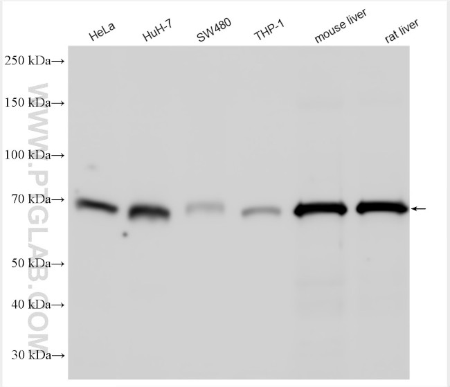 SOAT1/ACAT1 Antibody in Western Blot (WB)