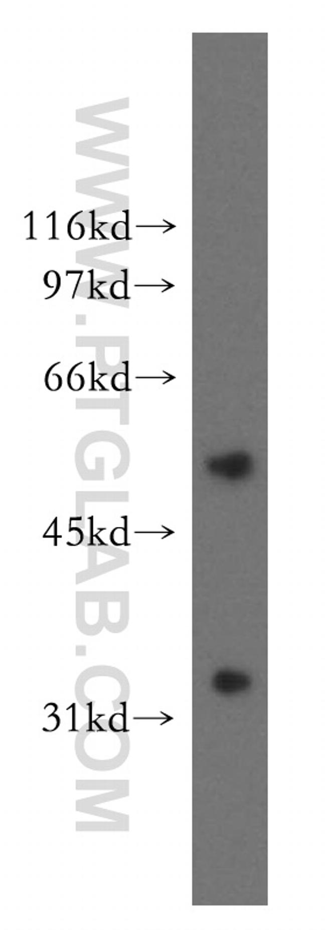 AKR7A3 Antibody in Western Blot (WB)
