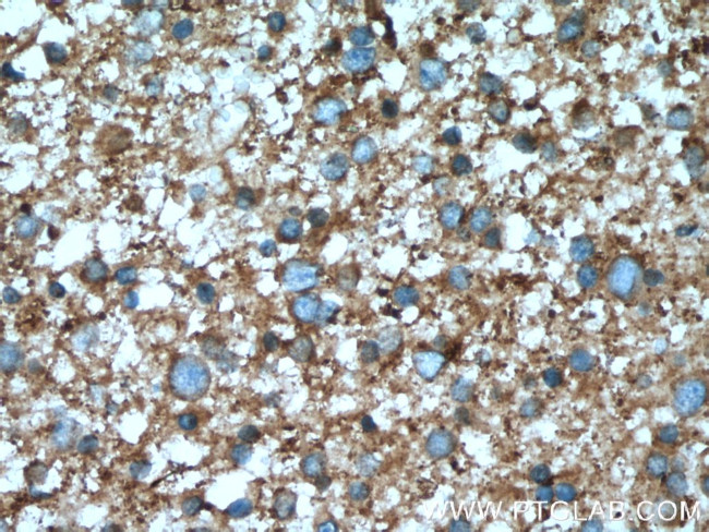 PPP3R1 Antibody in Immunohistochemistry (Paraffin) (IHC (P))