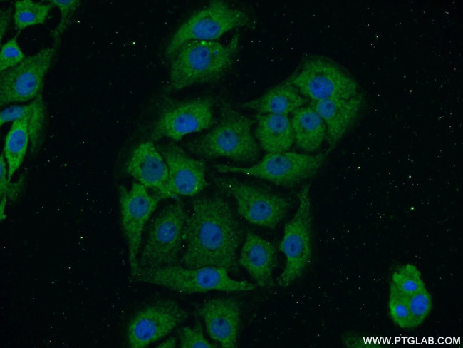 PACSIN1 Antibody in Immunocytochemistry (ICC/IF)