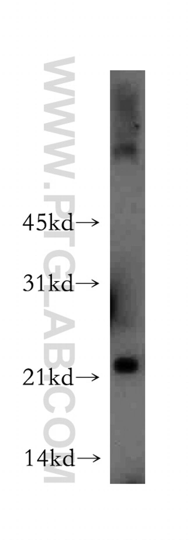 MYL4 Antibody in Western Blot (WB)