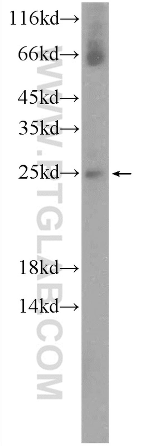 NMNAT3 Antibody in Western Blot (WB)