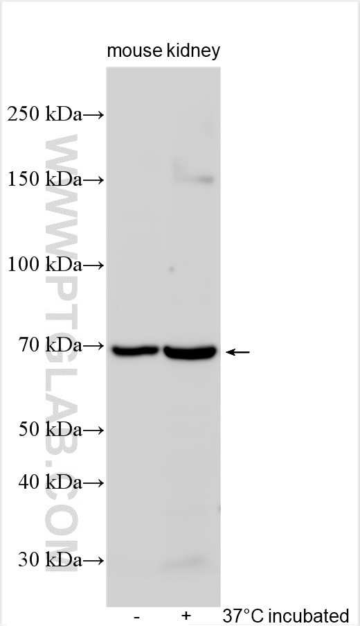 SLC22A4 Antibody in Western Blot (WB)
