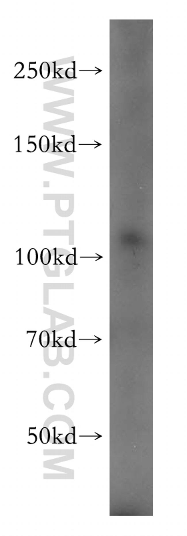 PI4KB Antibody in Western Blot (WB)