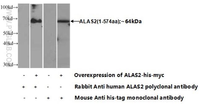 ALAS2 Antibody in Western Blot (WB)