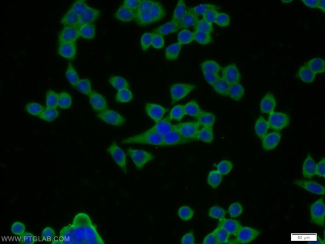 FGFBP2 Antibody in Immunocytochemistry (ICC/IF)