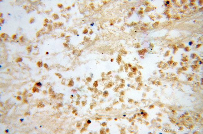 DLX3 Antibody in Immunohistochemistry (Paraffin) (IHC (P))