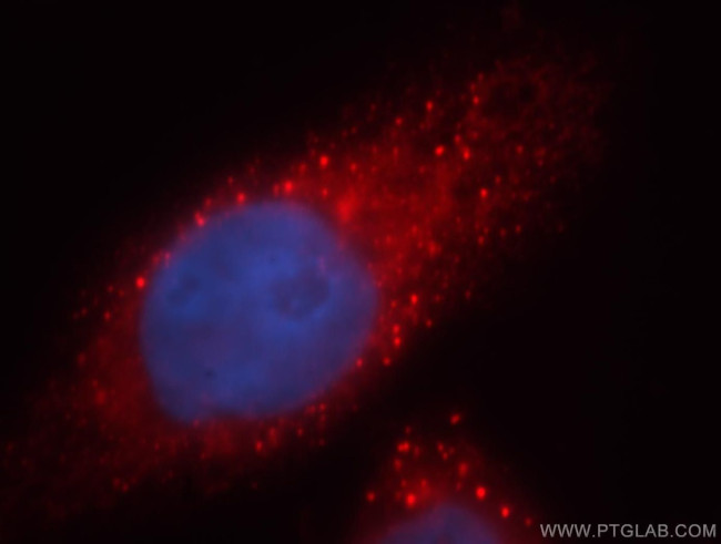 MPPED2 Antibody in Immunocytochemistry (ICC/IF)