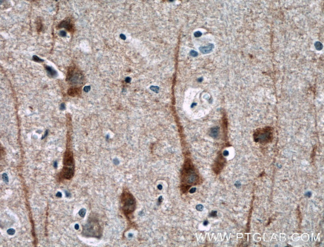 NGEF Antibody in Immunohistochemistry (Paraffin) (IHC (P))